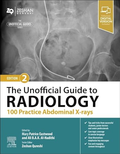 The Unofficial Guide to Radiology: 100 Practice Abdominal X-rays (Unofficial Guides) von Elsevier